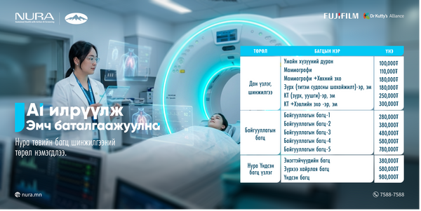 НУРА эрт илрүүлгийн төв багцуудаа төрөлжүүллээ